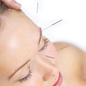 acupuncture being used for a variety of ailments